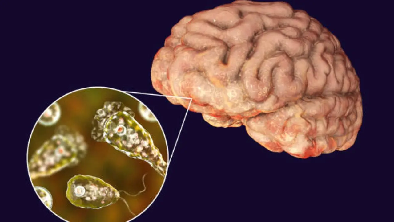 amoeba virus